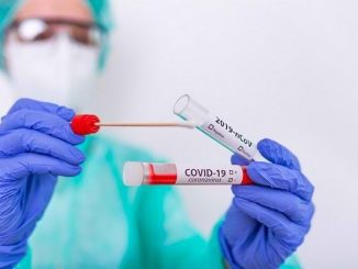 Ilustrasi tes pemeriksaan Covid-19. Mulai 18 Desember keluar masuk Jakarta wajib sertakan hasil Rapid Test Antigen. (KalderaNews/Ist)