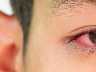 Mata Merah Pada Anak