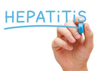Hepatitis. (Ist.)